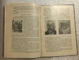 Книга по офтальмологии 1911 г., фото №10