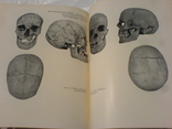Антропологічна характеристика давнього населення території України 1968г-тираж 800, фото №3