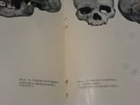 Антропологічна характеристика давнього населення території України 1968г-тираж 800, фото №10
