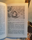 Книги про медицину. Пухлина і не тільки, фото №8