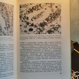 Книги про медицину. Пухлина і не тільки, фото №9