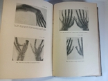 Textbook of Private Surgery, S. Girgolab, 1940, photo number 2