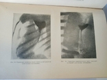 Textbook of Private Surgery, S. Girgolab, 1940, photo number 6