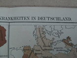 Болезни в Германии в начале 20 века. 244х 305 мм,1910-е гг, нем. язык, фото №4