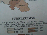 Болезни в Германии в начале 20 века. 244х 305 мм,1910-е гг, нем. язык, фото №9