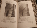 Буль "Гипноз и внушение в клинике внутрених болезней" 1958г., photo number 7