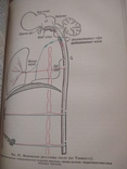 Патологическая физиология. Автор проф. Де Альперн 1938 г., фото №4