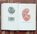 Патологическая анатомия издание 1954 год, фото №4