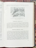 Патологическая анатомия издание 1954 год, фото №10