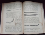 1907 г. СПб изд. Эттингер, проф. Оберлендер, Хронический перелой, фото №10