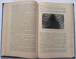 Н. М. Мусуляк, І. Н. Рибкін «Внутрішні хвороби (з доглядом за хворими)». 1970. 304 с. : іл., фото №13