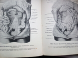 Атлас анатомии человека,том2,том3,авт.Р.Д.Синельников, фото №9