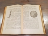 А.І.Абрикосов. Основи приватної патологічної анатомії. 1950., фото №6