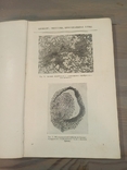 Диференціальна діагностика захворювань легенів. 601 малюнок. 1950., фото №12