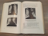 Р.Хегглін. Диференціальна діагностика внутрішніх хвороб. 1965., фото №7