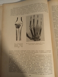 "Курс рентгенології і радіології". 1972., фото №3
