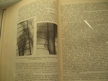 Неотложная рентгенодиагностика. Руководство для врачей.1957 год., фото №7
