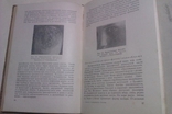 Фандеев Л. И. Кожные и венерические болезни. М. Медгиз 1954г., фото №5