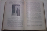 Фандеев Л. И. Кожные и венерические болезни. М. Медгиз 1954г., фото №12