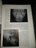 1944 год Военная медицина два тома одним лотом, фото №8