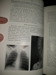 1944 год Военная медицина два тома одним лотом, фото №14