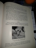 1944 год Военная медицина два тома одним лотом, фото №27