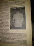 1938 год Учебник венерических и кожных болезней, фото №6