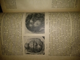 1938 год Учебник венерических и кожных болезней, фото №24