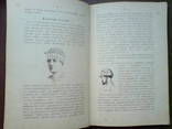 Десмургия. Руководство к изучению хирургических повязок 1890г. 164 рисунка, фото №7