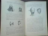 Десмургия. Руководство к изучению хирургических повязок 1890г. 164 рисунка, фото №8