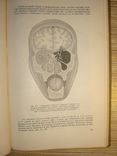 Огнестрельные ранения черепа и головного мозга, фото №5