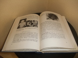 Книга Э. Керпель- Фрониус "Педиатрия" Будапешт 1975 год, фото №8