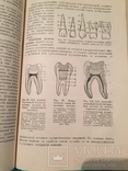 Болезни зубов и полости рта,1949г, фото №6
