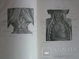 Анатомический атлас человеческого тела в 3-х томах., фото №13