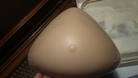 Имплантант груди., photo number 4
