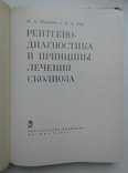 Рентгенодиагностика и принципы лечения сколиоза, фото №4