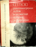 Атлас рентгенограмм зубов и челюстей в норме и патологии 1968г., фото №2