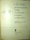 Атлас рентгенограмм зубов и челюстей в норме и патологии 1968г., фото №3