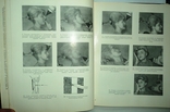 Атлас рентгенограмм зубов и челюстей в норме и патологии 1968г., фото №4
