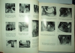 Атлас рентгенограмм зубов и челюстей в норме и патологии 1968г., фото №6
