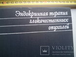 Эндокринная терапия злокачественных опухолей тир 8000, фото №3