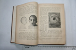 Семіотика и діагностика дитячих захворювань. 1912, фото №7