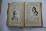 Семіотика и діагностика дитячих захворювань. 1912, фото №8