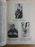 С. Трегубов. Ортопедия. 1938 год. Тираж - 5 тысяч., фото №4