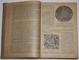 Основы общей патологоанатомической анатомии.,А.И.Абрикосов (1935 год), фото №6