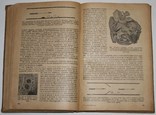 Основы общей патологоанатомической анатомии.,А.И.Абрикосов (1935 год), фото №7