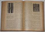 Основы общей патологоанатомической анатомии.,А.И.Абрикосов (1935 год), фото №8