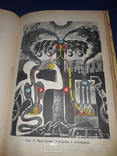 1930 Оборотный капитал жизни, Эрготизм, Плевриты - 3 книги, фото №5