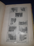 1930 Оборотный капитал жизни, Эрготизм, Плевриты - 3 книги, фото №10