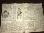 1924 Венерические заболевания Сифилис, Знание 41, фото №13